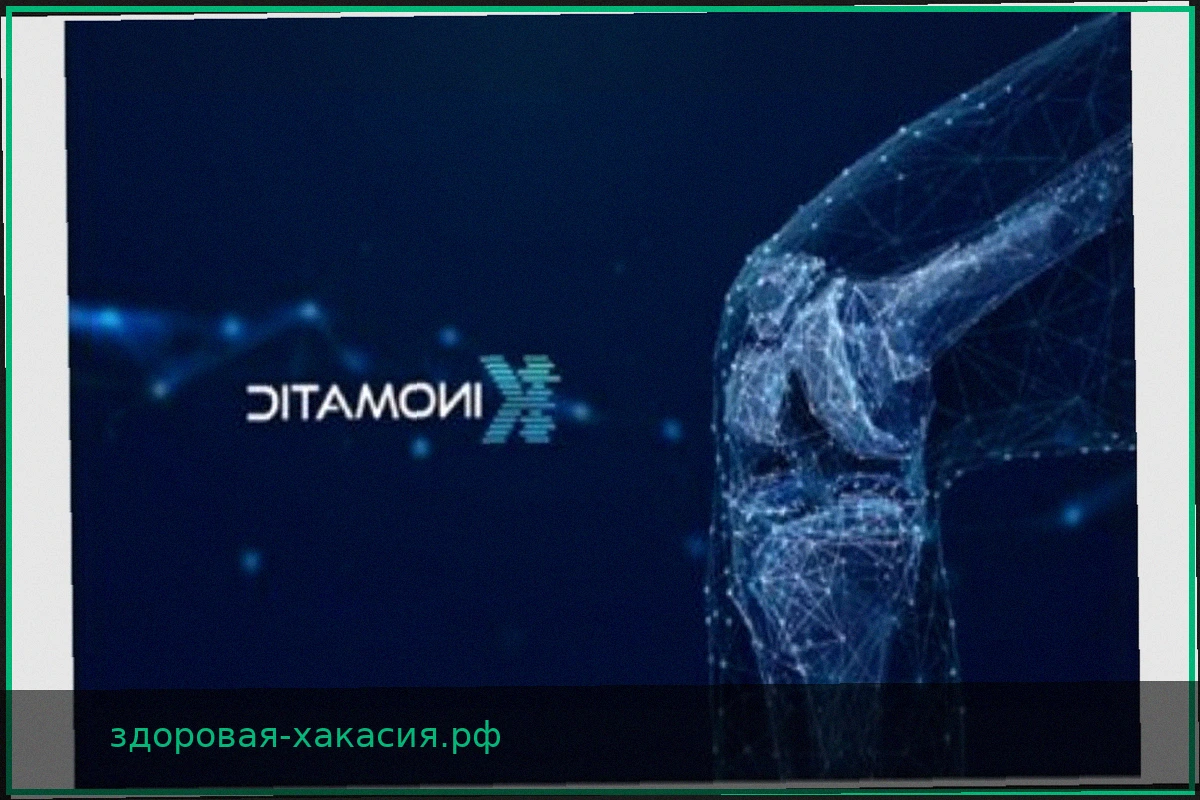 Kinomatic Представляет Единую Платформу для Развития Ортопедической Хирургии на Базе Искусственного Интеллекта